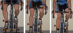 Cyclist with knee pain at Singapore Phys.