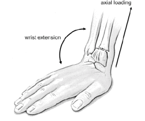wrist extension