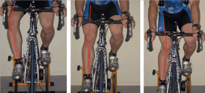 Patient undergoing seated leg strength测试.