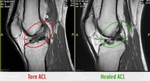 Spinal correction before and after.