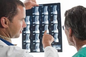 Doctors reviewing spinal MRI scans at a诊.